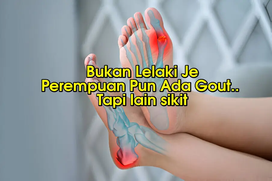 tanda tanda gout perempuan